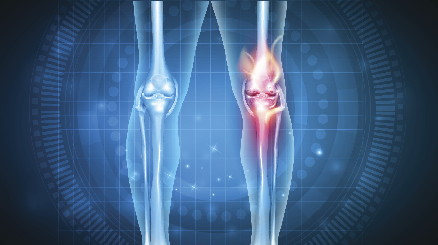Reassurance For Those Recently Diagnosed with Arthritis
