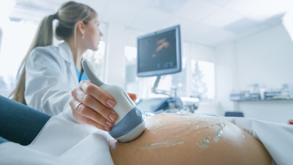Do 4D Ultrasound