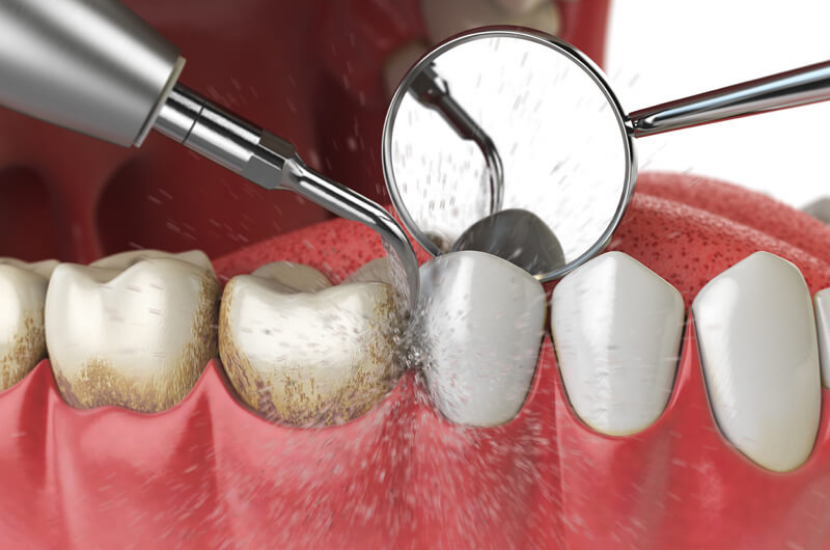 Everything You Need to Know About Periodontal Care