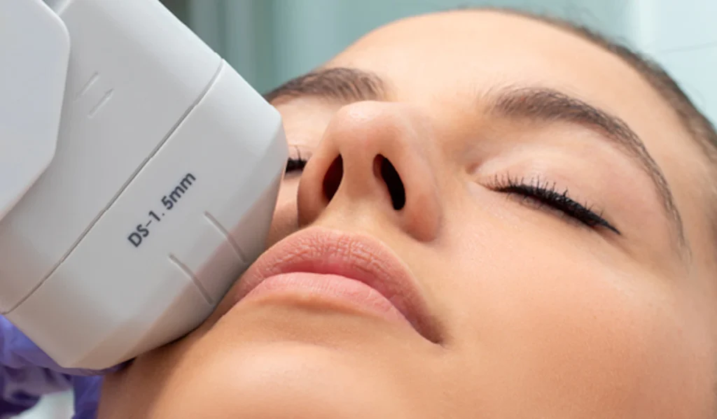 What to Consider Before Getting HIFU for Skin Tightening