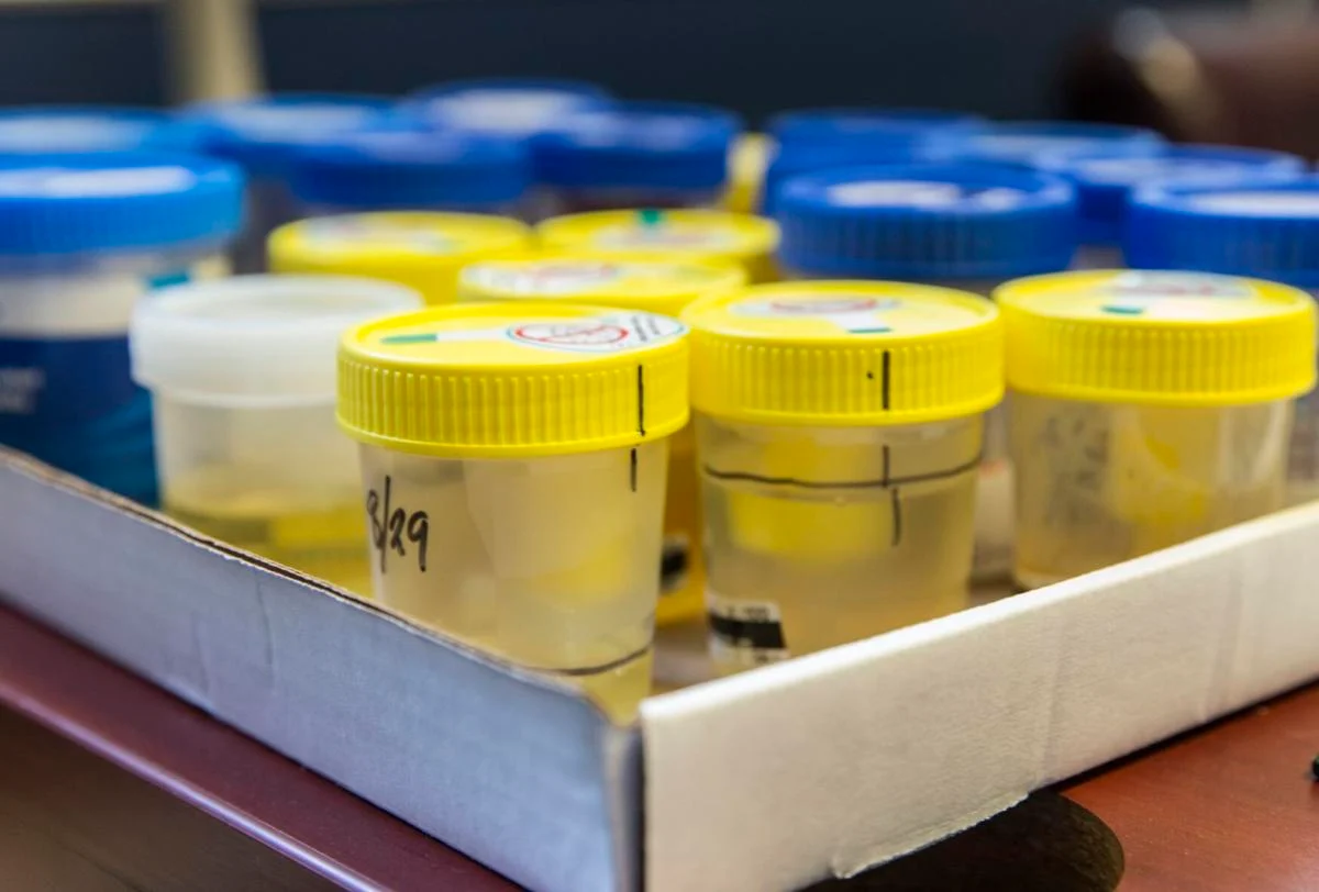 Swab vs. Urine Who is the Winner in the Drug Testing Arena Health