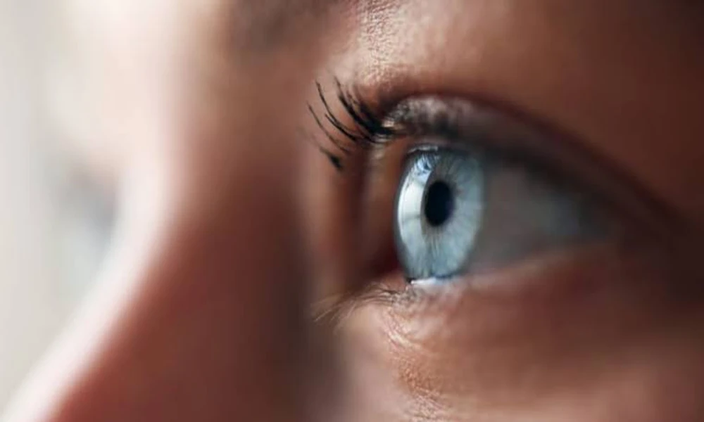 Upper Eyelid Surgery Creating Defined Eye Features with Natural-Looking Results