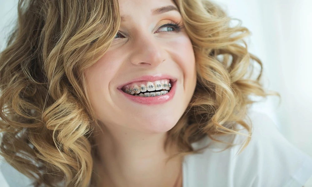 Are Adult Braces as Effective as Braces for Teenagers?